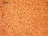 6 - Tetrasporocisti in visione superficiale